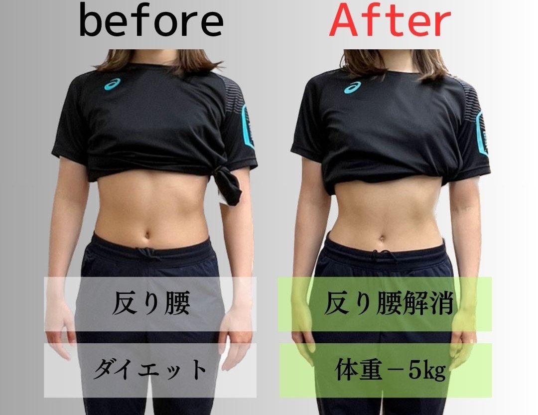 姿勢とダイエットのビフォーアフター例